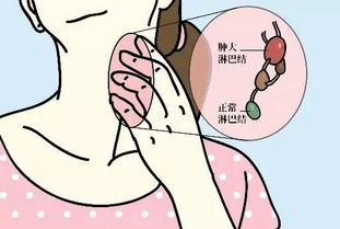 肿胀,心会神凝造句