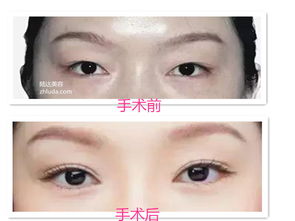 请问一下,这个是什么眼型?