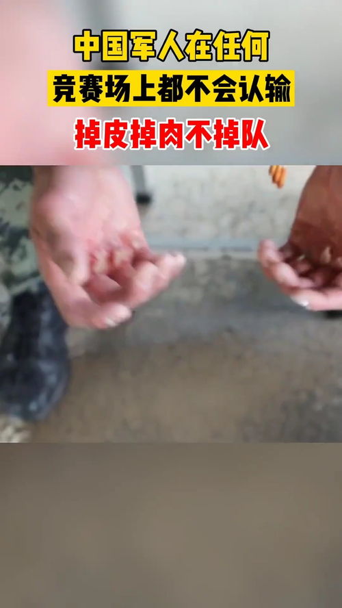 掉皮是什么原因引起的，掉皮肤屑是什么原因